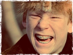 Farkus
